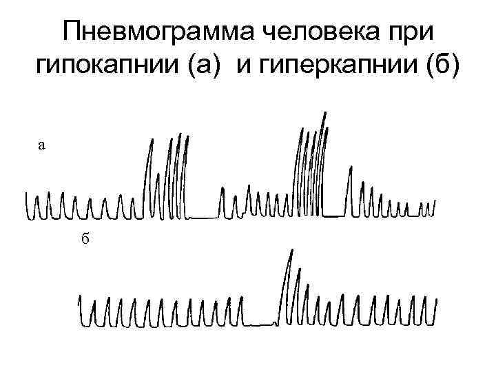 Пневмограмма человека при гипокапнии (а) и гиперкапнии (б) а б 