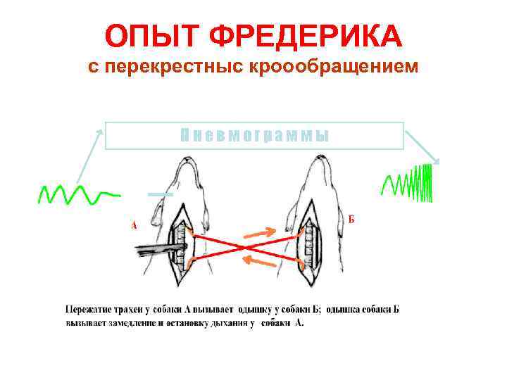 ОПЫТ ФРЕДЕРИКА с перекрестныс кроообращением Пневмограммы 