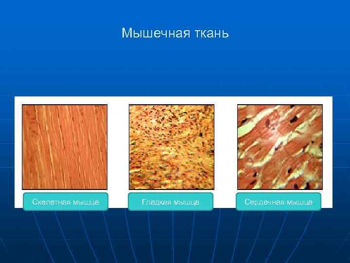 Мышечная ткань Скелетная мышца Гладкая мышца Сердечная мышца 