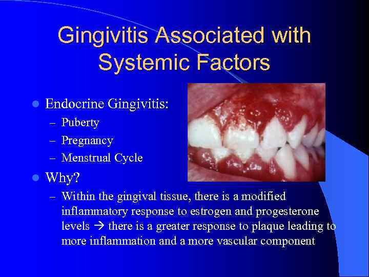 Gingivitis Associated with Systemic Factors l Endocrine Gingivitis: – Puberty – Pregnancy – Menstrual