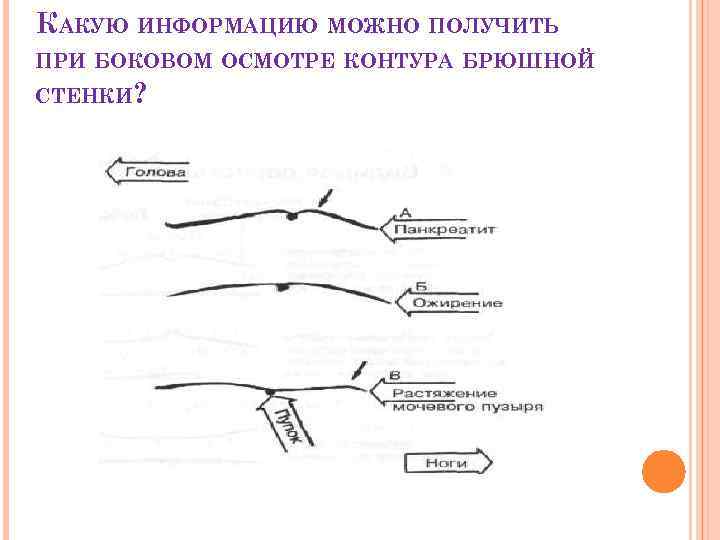 КАКУЮ ИНФОРМАЦИЮ МОЖНО ПОЛУЧИТЬ ПРИ БОКОВОМ ОСМОТРЕ КОНТУРА БРЮШНОЙ СТЕНКИ? 