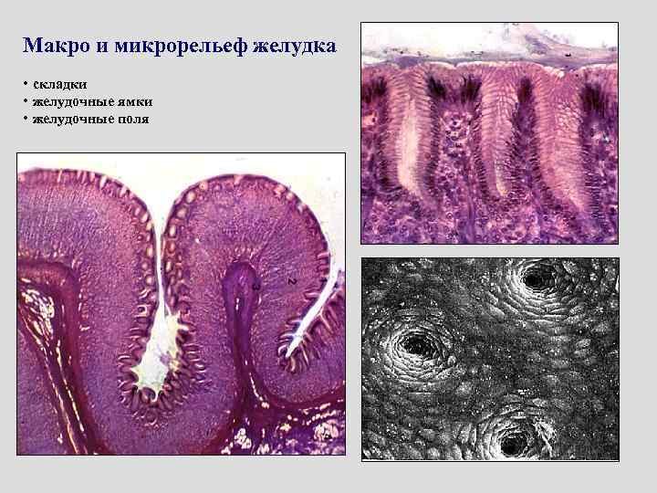 Макро и микрорельеф желудка • складки • желудочные ямки • желудочные поля 