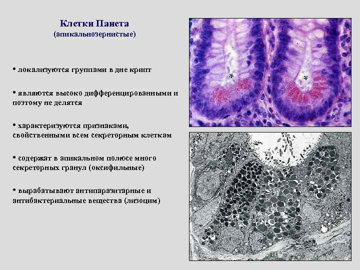 Строение стенки каверны