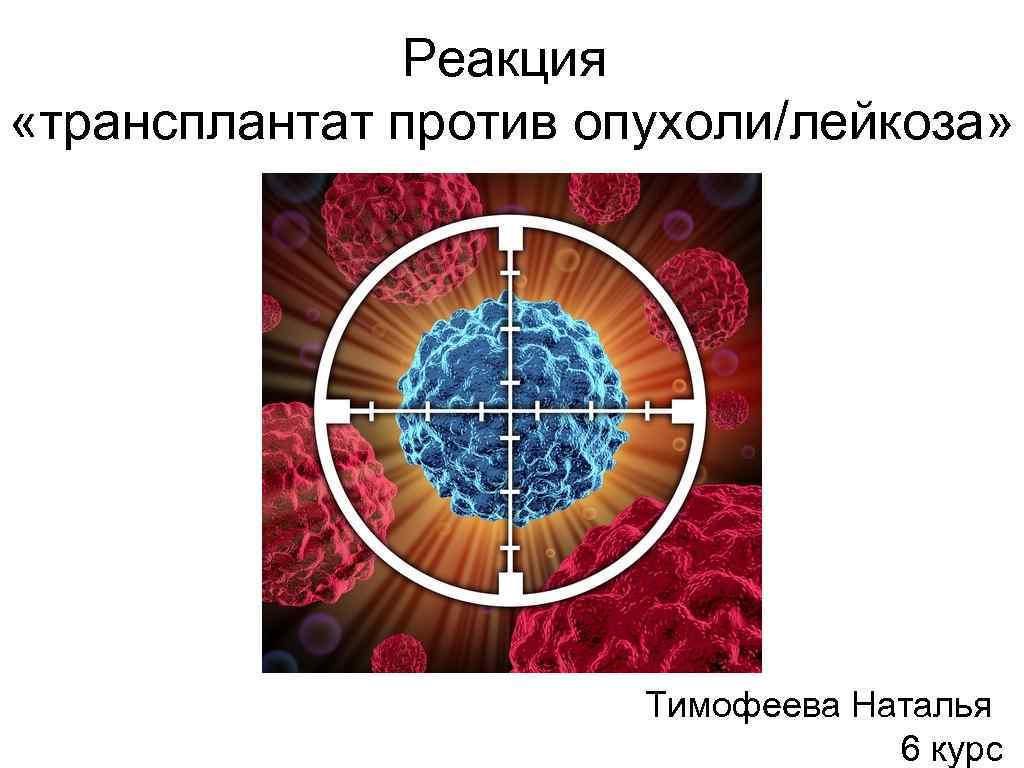 Реакция «трансплантат против опухоли/лейкоза» Тимофеева Наталья 6 курс 