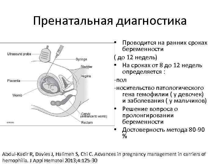 Пренатальная диагностика • Проводится на ранних сроках беременности ( до 12 недель) • На