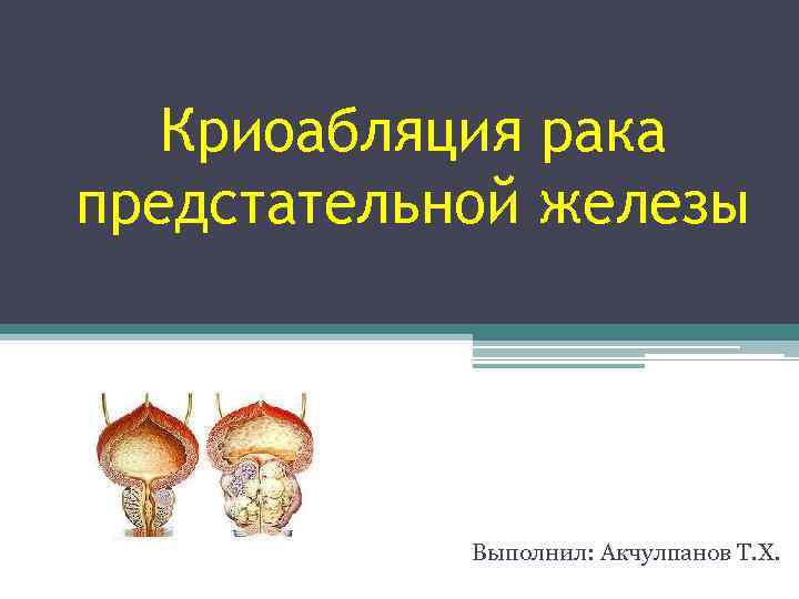 Криоабляция рака предстательной железы Выполнил: Акчулпанов Т. Х. 