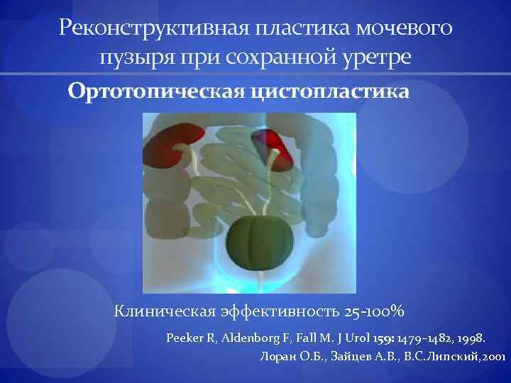 Реконструктивная пластика мочевого пузыря при сохранной уретре Ортотопическая цистопластика Клиническая эффективность 25 -100% Peeker