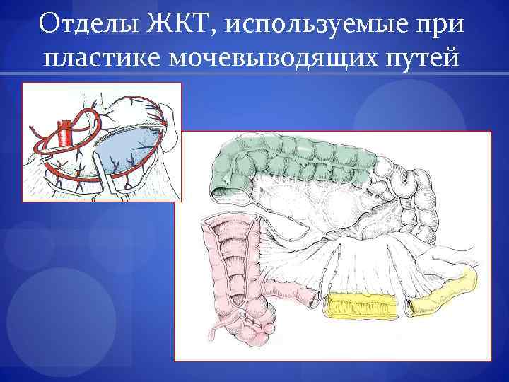 Отделы ЖКТ, используемые при пластике мочевыводящих путей 