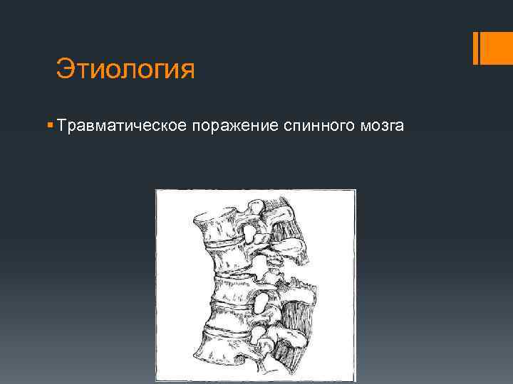 Этиология § Травматическое поражение спинного мозга 