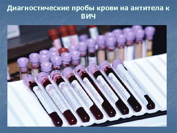 Диагностические пробы крови на антитела к ВИЧ 