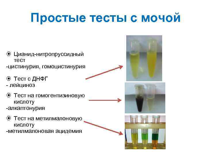 Алкаптонурия клиническая картина