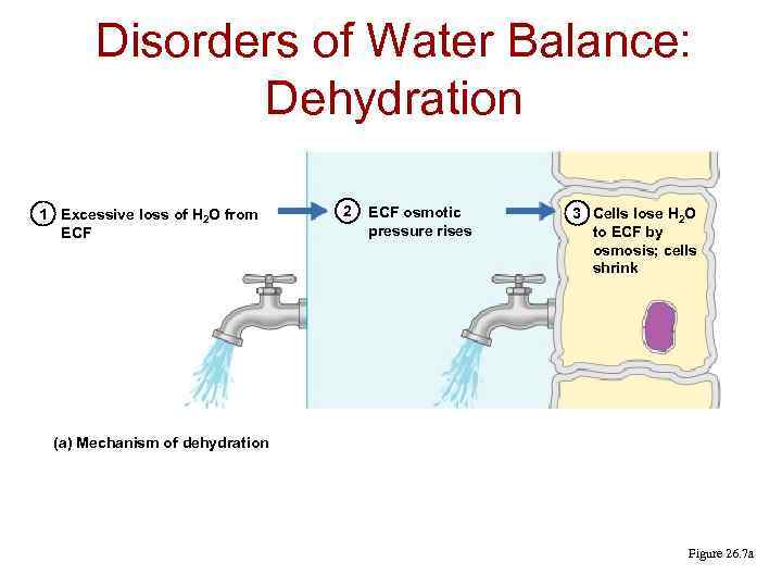 Disorders of Water Balance: Dehydration 1 Excessive loss of H 2 O from ECF