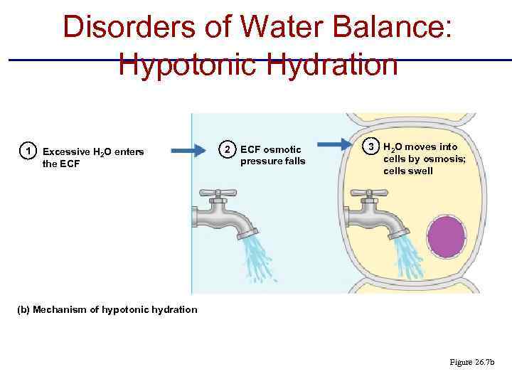 Disorders of Water Balance: Hypotonic Hydration 1 Excessive H 2 O enters the ECF