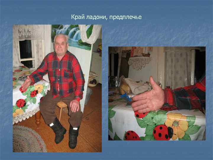 Край ладони, предплечье 