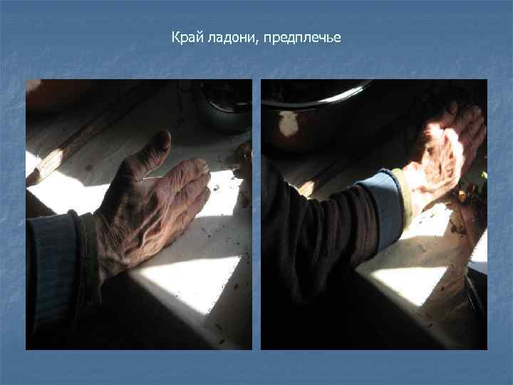 Край ладони, предплечье 