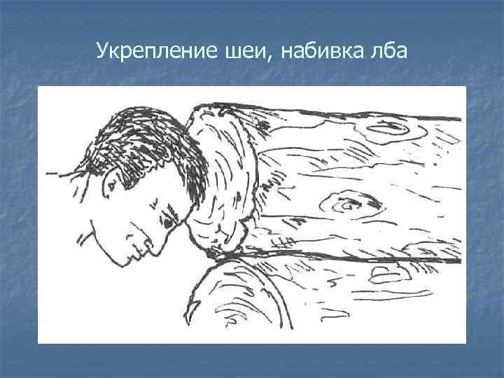 Укрепление шеи, набивка лба 