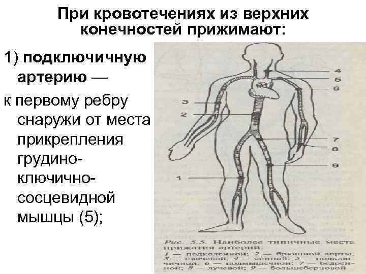 Как производится пальцевое прижатие подключичной артерии. Прижатие подключичной артерии при кровотечении. Подключичную артерию прижимают к первому ребру при кровотечении из. Подключичную артерию прижимаем к 1 ребру при кровотечении из:. Пальцевое прижатие подключичной артерии.