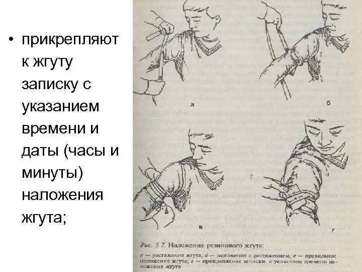 Норколут при кровотечении схема