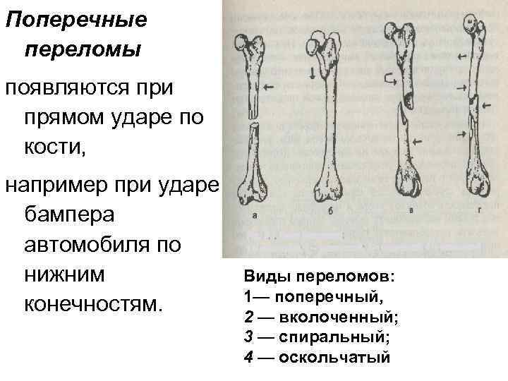 Тип костей ноги