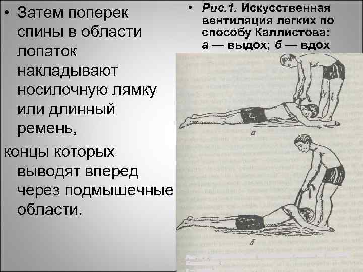  • Затем поперек спины в области лопаток накладывают носилочную лямку или длинный ремень,