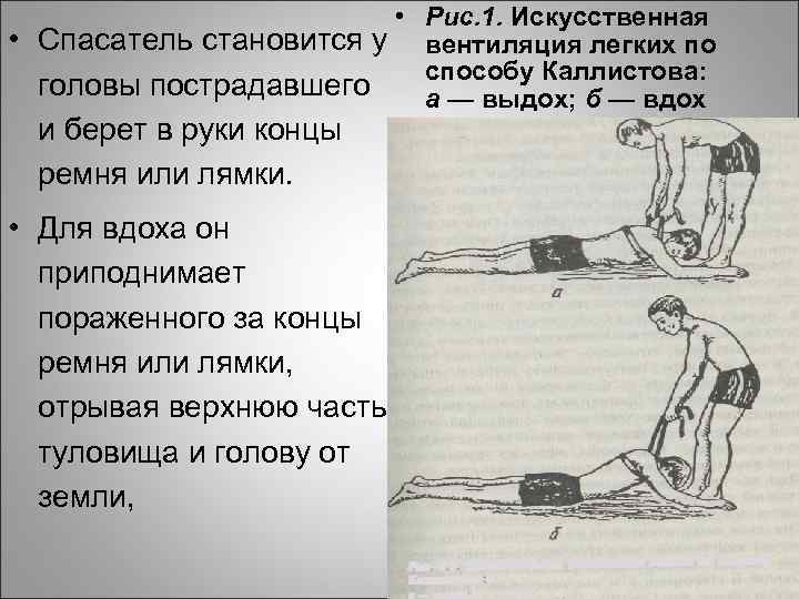  • Рис. 1. Искусственная • Спасатель становится у вентиляция легких по способу Каллистова: