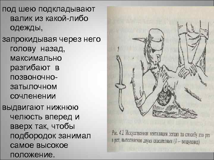 под шею подкладывают валик из какой-либо одежды, запрокидывая через него голову назад, максимально разгибают