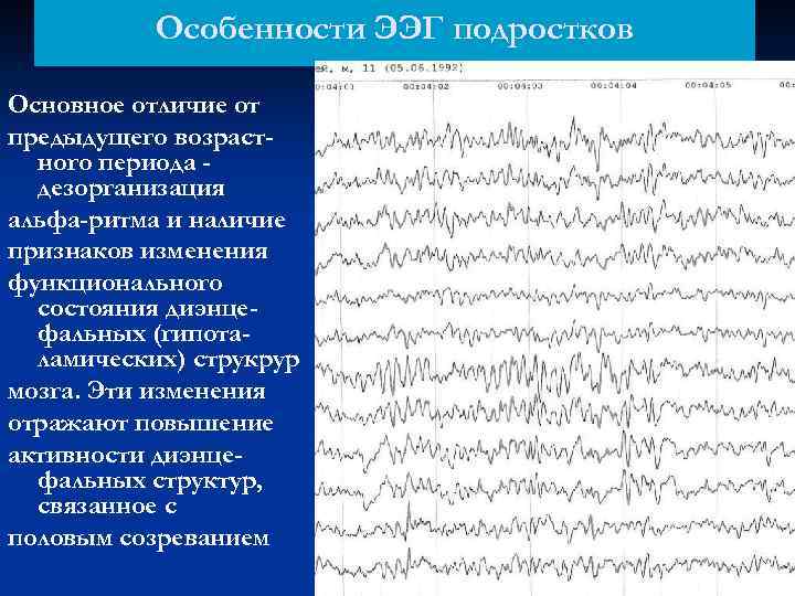 Легкие диффузные изменения биоэлектрической активности …