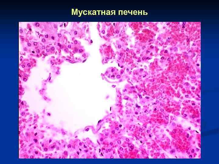 Мускатная печень 