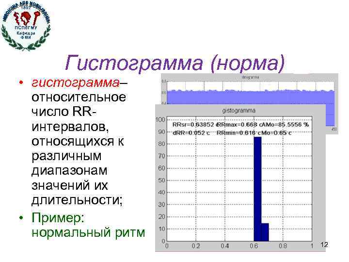 1897 ПСПб. ГМУ Кафедра ФМИ Кафедра физики, математики и информатики Гистограмма (норма) • гистограмма–