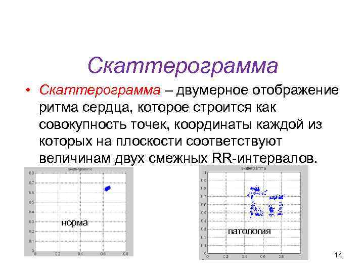 Кафедра физики, математики и информатики Скаттерограмма • Скаттерограмма – двумерное отображение ритма сердца, которое