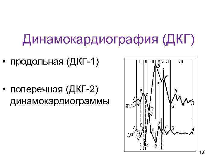 Кафедра физики, математики и информатики Динамокардиография (ДКГ) • продольная (ДКГ-1) • поперечная (ДКГ-2) динамокардиограммы