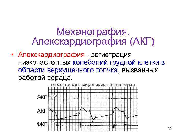 Кафедра физики, математики и информатики Механография. Апекскардиография (АКГ) • Апекскардиография– регистрация низкочастотных колебаний грудной