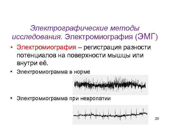 Кафедра физики, математики и информатики Электрографические методы исследования. Электромиография (ЭМГ) • Электромиография – регистрация