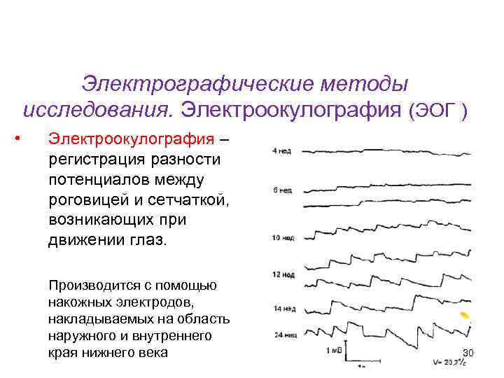 Кафедра физики, математики и информатики Электрографические методы исследования. Электроокулография (ЭОГ ) • Электроокулография –