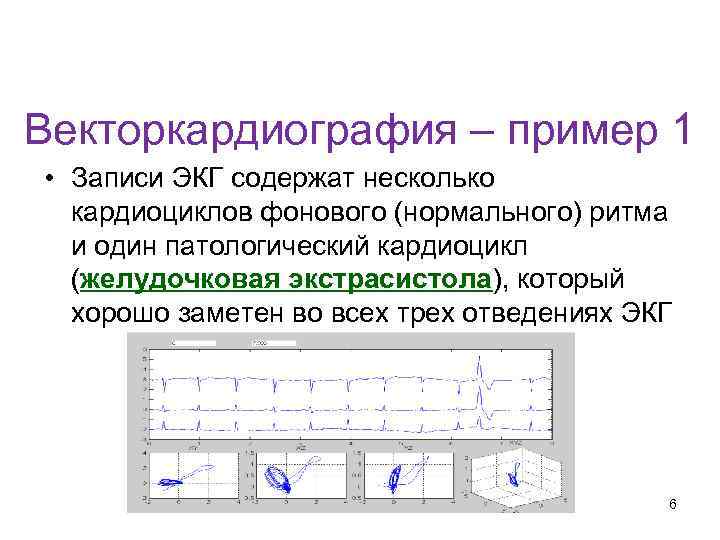 Кафедра физики, математики и информатики Векторкардиография – пример 1 • Записи ЭКГ содержат несколько