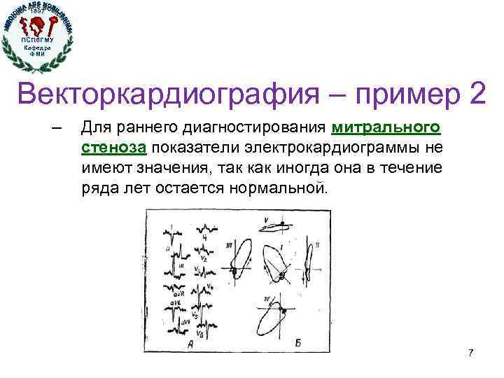 1897 ПСПб. ГМУ Кафедра ФМИ Кафедра физики, математики и информатики Векторкардиография – пример 2