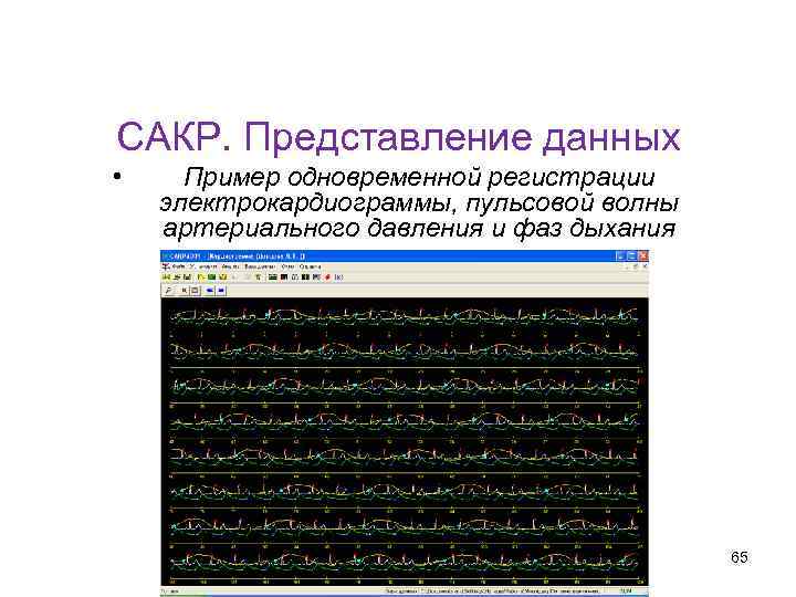 Кафедра физики, математики и информатики САКР. Представление данных • Пример одновременной регистрации электрокардиограммы, пульсовой