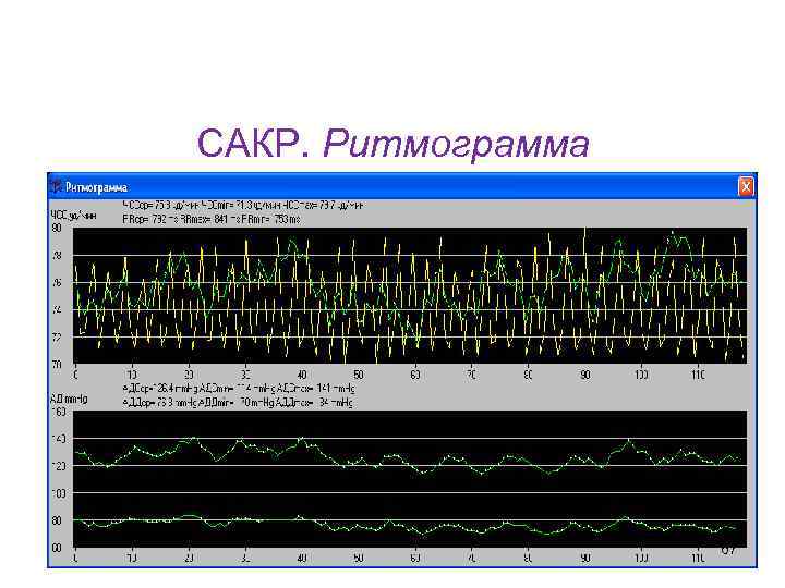 Кафедра физики, математики и информатики САКР. Ритмограмма 67 