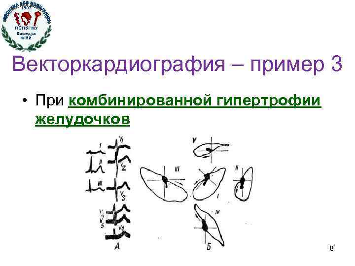 1897 ПСПб. ГМУ Кафедра ФМИ Кафедра физики, математики и информатики Векторкардиография – пример 3