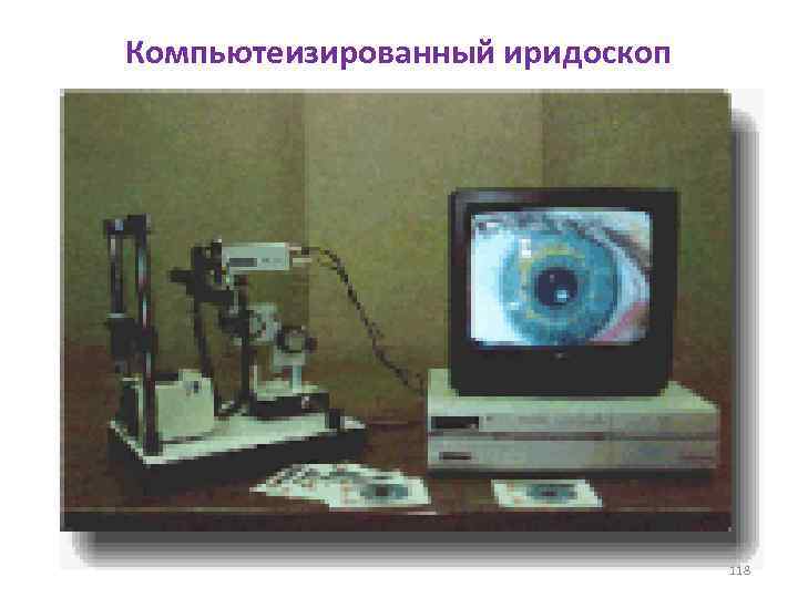Компьютеизированный иридоскоп 118 