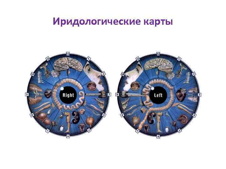 Иридологические карты 