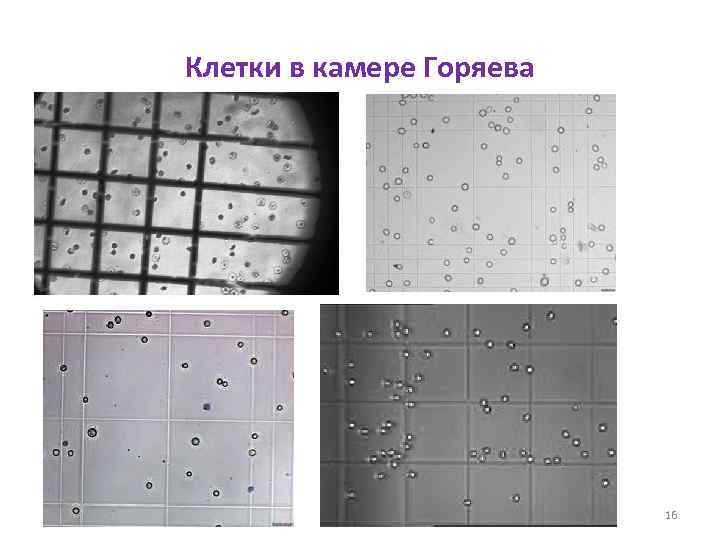 Клетки в камере Горяева 16 