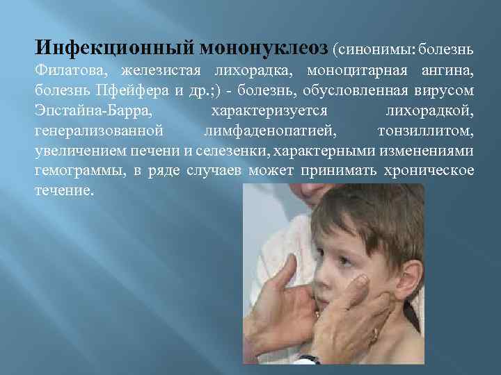 Инфекционный мононуклеоз (синонимы: болезнь Филатова, железистая лихорадка, моноцитарная ангина, болезнь Пфейфера и др. ;