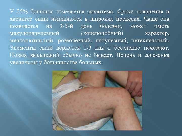 У 25% больных отмечается экзантема. Сроки появления и характер сыпи изменяются в широких пределах.