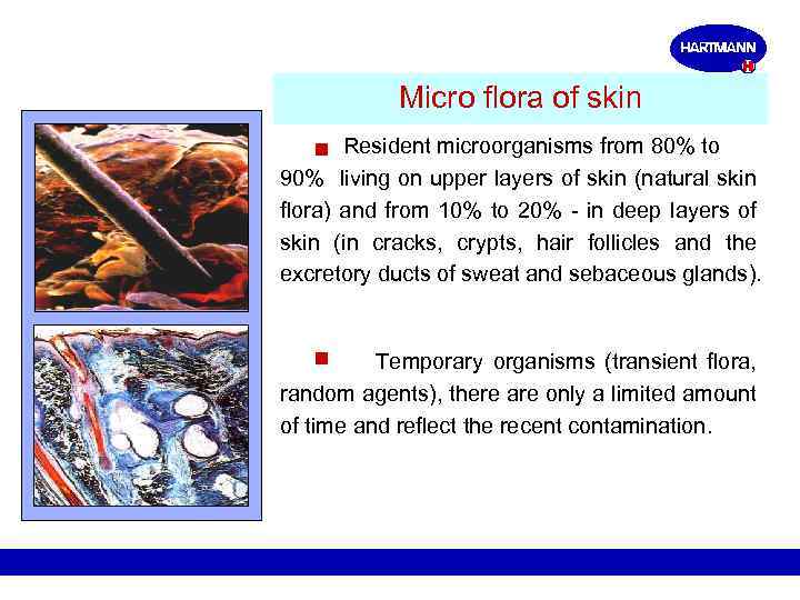 Micro flora of skin Resident microorganisms from 80% to 90% living on upper layers