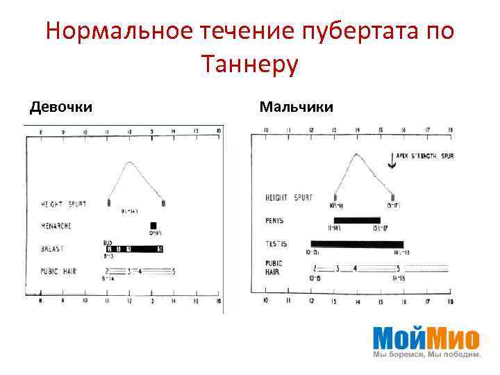 Нормальное течение пубертата по Таннеру Девочки Мальчики 