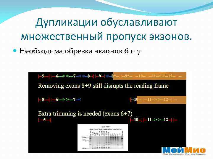 Дупликации обуславливают множественный пропуск экзонов. Необходима обрезка экзонов 6 и 7 