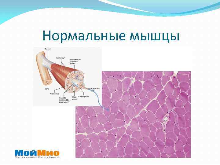 Нормальные мышцы 