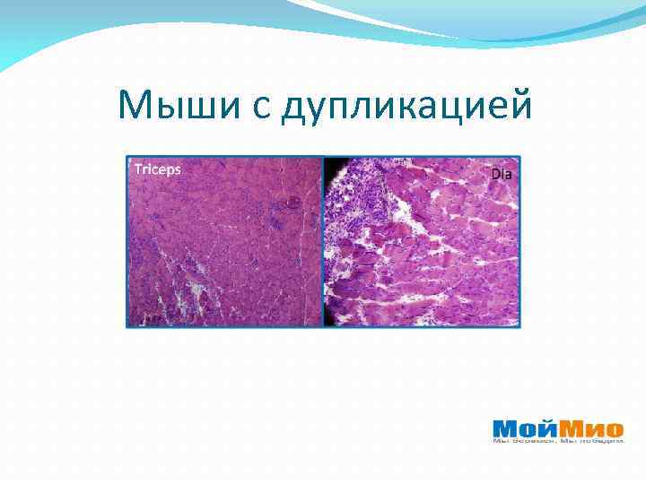 Мыши с дупликацией 