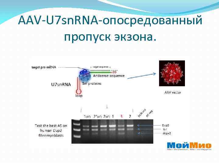AAV-U 7 sn. RNA-опосредованный пропуск экзона. 